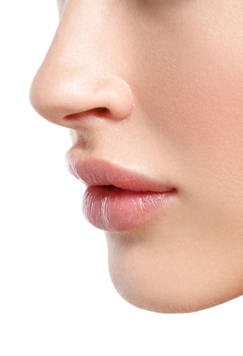 Nasen unterspritzung ohne OP mit Hyaluronsäure im MoreBeauty Gleisdorf