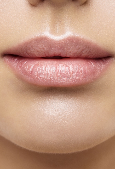 Lipfiller, Lippen unterspritzung mit Hyaluronsäure im Morebeauty Gleisdorf